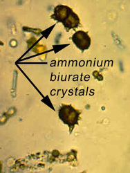 Ammonium Biurate Crystal